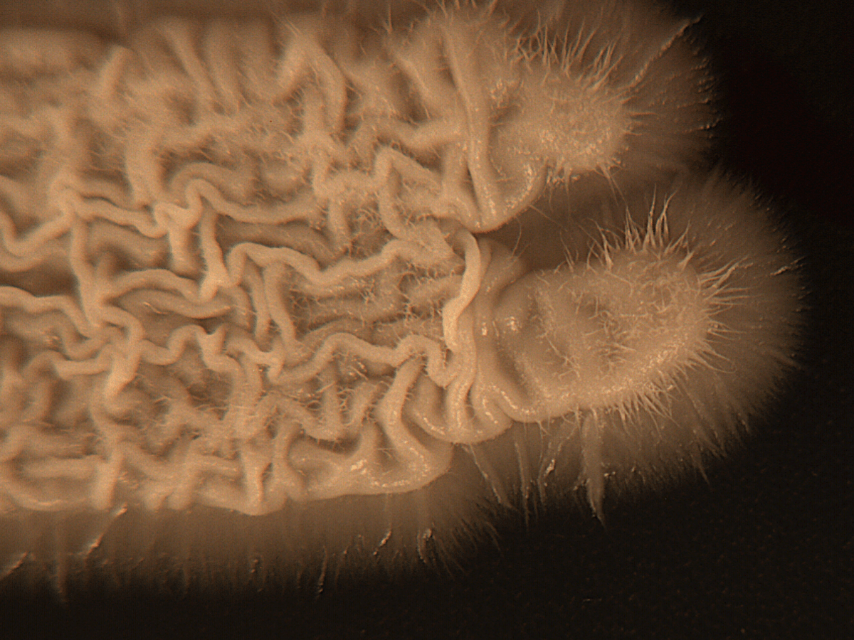 Natural Genetic Variation Reveals Surprises About A Fungal&nbsp;Pathogen